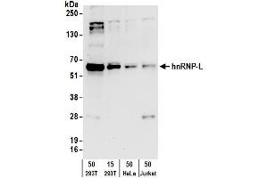 Western Blotting (WB) image for anti-Heterogeneous Nuclear Ribonucleoprotein L (HNRNPL) (AA 350-400) antibody (ABIN7795591) (HNRNPL Antikörper  (AA 350-400))