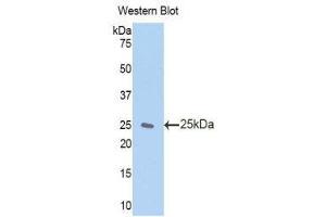 Western Blotting (WB) image for anti-Zinc Finger, AN1-Type Domain 6 (ZFAND6) (AA 19-208) antibody (ABIN1860972) (ZFAND6 Antikörper  (AA 19-208))