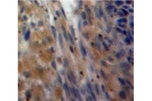 Used in DAB staining on fromalin fixed paraffin-embedded Ovary tissue (Inhibin alpha Antikörper  (AA 233-366))
