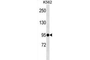 Western Blotting (WB) image for anti-Extracellular Leucine-Rich Repeat and Fibronectin Type III Domain Containing 1 (ELFN1) antibody (ABIN5020065) (ELFN1 Antikörper)