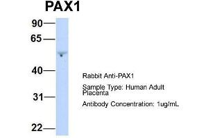 Host:  Rabbit  Target Name:  PAX1  Sample Type:  Human Adult Placenta  Antibody Dilution:  1.