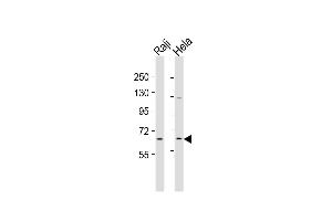 Western Blot at 1:2000 dilution Lane 1: Raji whole cell lysates Lane 2: Hela whole cell lysates Lysates/proteins at 20 ug per lane. (MLLT1 Antikörper  (C-Term))