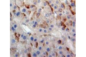 Used in DAB staining on fromalin fixed paraffin-embedded Liver tissue (ABCB11 Antikörper  (AA 420-656))