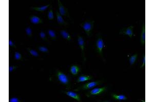 Immunofluorescent analysis of HeLa cells using Diamine acetyltransferase 1 Antibody (1/100 dilution) and AF488-conjugated Goat Anti-Rabbit IgG (H+L) secondary antibody. (SAT1 Antikörper  (AA 5-171))