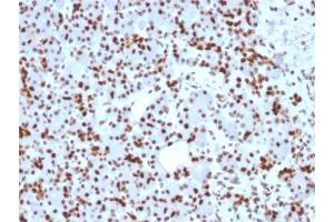 Formalin-fixed, paraffin-embedded human Pancreas stained with SOX9 Mouse Monoclonal Antibody (SOX9/2398).