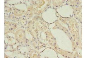 Immunohistochemistry of paraffin-embedded human kidney tissue using ABIN7143242 at dilution of 1:100 (ACOT9 Antikörper  (AA 1-212))
