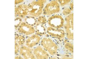 Immunohistochemistry of paraffin-embedded human kidney using CALCOCO1 antibody at dilution of 1:100 (40x lens). (CALCOCO1 Antikörper)