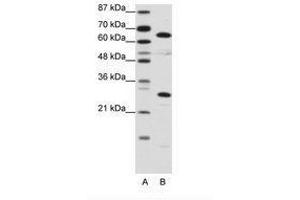 Image no. 1 for anti-High Mobility Group Box 4 (HMGB4) (C-Term) antibody (ABIN6736129) (HMGB4 Antikörper  (C-Term))