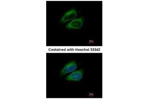 ICC/IF Image Immunofluorescence analysis of methanol-fixed HeLa, using CSDE1, antibody at 1:200 dilution. (CDSE1 Antikörper  (Internal Region))