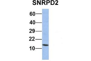 Host:  Rabbit  Target Name:  SNRPD2  Sample Type:  Human Jurkat  Antibody Dilution:  1. (SNRPD2 Antikörper  (Middle Region))