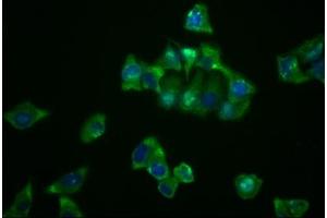 Immunofluorescence staining of Hela cells with ABIN7127637 at 1:23, counter-stained with DAPI. (Rekombinanter NDRG1 Antikörper)