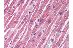 Image no. 1 for anti-Tuberous Sclerosis 1 (TSC1) antibody (ABIN302894) (TSC1 Antikörper)