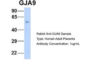 Host: Rabbit Target Name: GJA9 Sample Type: Human Adult Placenta Antibody Dilution: 1. (GJA9 Antikörper  (Middle Region))