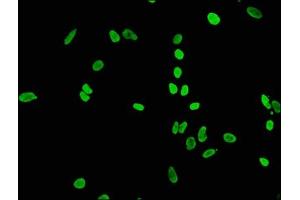Immunofluorescence staining of Hela cells(treated by 15 mM sodium butyrate for 30 min) with ABIN7127271 at 1:65,counter-stained with DAPI. (Rekombinanter HIST1H4A Antikörper  (acLys56))