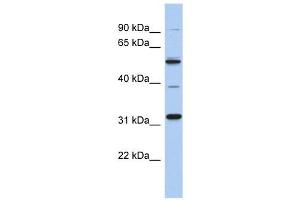 MGC51025 antibody used at 1 ug/ml to detect target protein. (TBC1D26 Antikörper  (Middle Region))