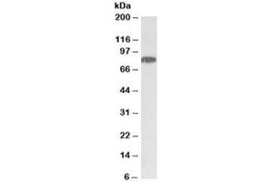 Western blot testing of HeLa nuclear lysate with CHUK antibody at 1ug/ml. (IKK alpha Antikörper)