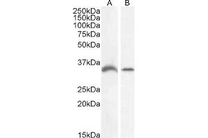 Western Blotting (WB) image for anti-Growth Differentiation Factor 15 (GDF15) (C-Term) antibody (ABIN185465)