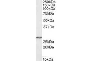 Western Blotting (WB) image for anti-NADH Dehydrogenase (Ubiquinone) Fe-S Protein 3, 30kDa (NADH-Coenzyme Q Reductase) (NDUFS3) (Internal Region) antibody (ABIN570974)