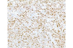Immunohistochemistry (IHC) image for anti-Minichromosome Maintenance Complex Component 2 (MCM2) (pSer108) antibody (ABIN7449366) (MCM2 Antikörper  (pSer108))