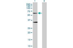 Western Blot analysis of GLRA1 expression in transfected 293T cell line by GLRA1 MaxPab polyclonal antibody. (GLRA1 Antikörper  (AA 1-449))