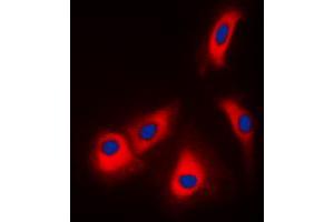 Immunofluorescent analysis of Adenosine Kinase staining in HepG2 cells. (ADK Antikörper  (N-Term))