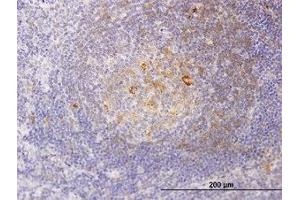 Image no. 1 for anti-Regulatory Solute Carrier Protein, Family 1, Member 1 (RSC1A1) (AA 1-101) antibody (ABIN466085)