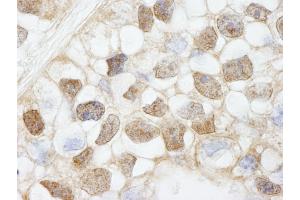 Immunohistochemistry (IHC) image for anti-Histone Deacetylase 7 (HDAC7) (AA 902-952) antibody (ABIN7448594) (HDAC7 Antikörper  (AA 902-952))