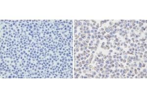 Immunohistochemical analysis of PDL-2 in untransfected(left) or transfected(right) with 293T cell sections. (PDCD1LG2 Antikörper  (N-Term))