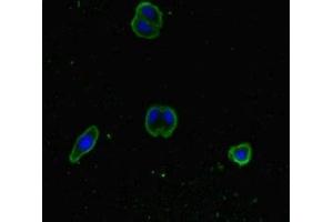 Immunofluorescent analysis of HepG2 cells using ABIN7170352 at dilution of 1:100 and Alexa Fluor 488-congugated AffiniPure Goat Anti-Rabbit IgG(H+L) (SNX14 Antikörper  (AA 601-893))