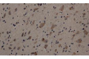 Immunohistochemistry of paraffin-embedded Rat brain using Cleaved-NOTCH1 (V1754) Polyclonal Antibody at dilution of 1:200