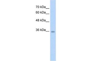 Western Blotting (WB) image for anti-Chromosome 6 Open Reading Frame 134 (C6orf134) antibody (ABIN2462612) (Chromosome 6 Open Reading Frame 134 (C6orf134) Antikörper)