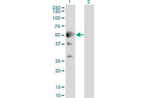 Western Blot analysis of SEPT10 expression in transfected 293T cell line by SEPT10 monoclonal antibody (M01), clone 2A12.