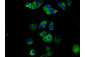 Immunofluorescence staining of MCF-7 cells with ABIN7160831 at 1:133, counter-stained with DAPI. (NLRP6 Antikörper  (AA 154-306))