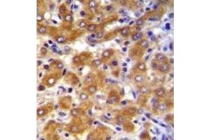 ABCB10 antibody immunohistochemistry analysis in formalin fixed and paraffin embedded human liver tissue. (ABCB10 Antikörper  (AA 1-27))