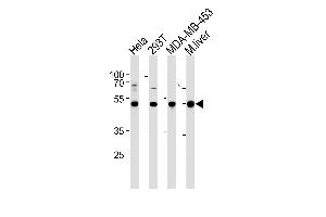 GSS Antibody (C-term) (ABIN390882 and ABIN2841094) western blot analysis in Hela,293T,MDA-MB-453 cell line and mouse liver tissue lysates (35 μg/lane).