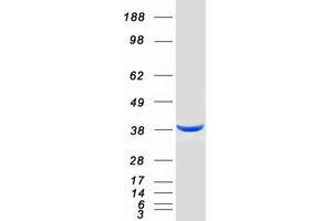 Western Blotting (WB) image for DNA Fragmentation Factor, 45kDa, alpha Polypeptide (DFFA) (Transcript Variant 1) protein (Myc-DYKDDDDK Tag) (ABIN2719434)