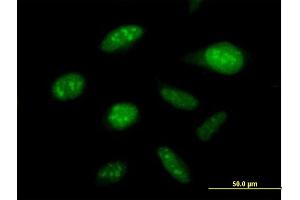 Immunofluorescence of purified MaxPab antibody to DDX50 on HeLa cell. (DDX50 Antikörper  (AA 1-737))