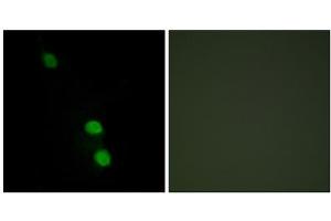 Immunofluorescence analysis of HepG2 cells, using TEAD2 antibody. (TEAD2 Antikörper  (Internal Region))