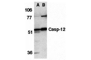 Western Blotting (WB) image for anti-Caspase 12 (Gene/pseudogene) (CASP12) (N-Term) antibody (ABIN1031295) (Caspase 12 Antikörper  (N-Term))