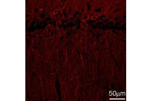 Indirect immunostaining of a rat hippocampus section fixed with 4 % PFA and 15 % picric acid (dilution 1 : 500).