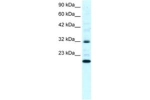 Western Blotting (WB) image for anti-rho GDP Dissociation Inhibitor (GDI) gamma (ARHGDIG) antibody (ABIN2460825)