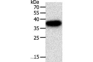 Western blot analysis of A549 cell, using PLAUR Polyclonal Antibody at dilution of 1:400 (PLAUR Antikörper)