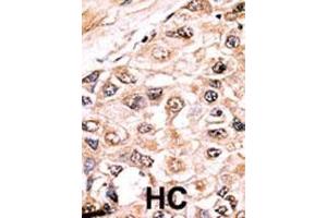 Immunohistochemistry (Paraffin-embedded Sections) (IHC (p)) image for anti-Activin Receptor Type I (ACRV1) (AA 138-170) antibody (ABIN391154)