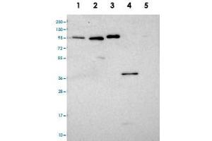 Western blot analysis of Lane 1: RT-4, Lane 2: U-251 MG, Lane 3: Human Plasma, Lane 4: Liver, Lane 5: Tonsil with CCDC19 polyclonal antibody  at 1:100-1:250 dilution. (CCDC19 Antikörper)