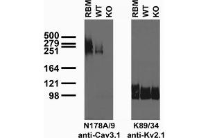 Immunoblot of crude brain membranes from adult rat (RBM) and Cav3. (Cav3.1 Ca2+ Channel (AA 2052-2172), (C-Term), (Cytosolic) Antikörper)