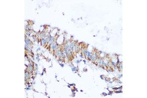 Immunohistochemistry of paraffin-embedded human colon using SIRT4 Rabbit pAb (ABIN6129330, ABIN6147796, ABIN6147797 and ABIN6223494) at dilution of 1:100 (40x lens).
