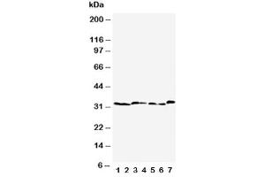 Western Blotting (WB) image for anti-Caspase 6, Apoptosis-Related Cysteine Peptidase (CASP6) (AA 7-27) antibody (ABIN3030314)
