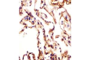 Antibody staining AOC3 in human lung tissue sections by Immunohistochemistry (IHC-P - paraformaldehyde-fixed, paraffin-embedded sections). (AOC3 Antikörper  (AA 613-640))