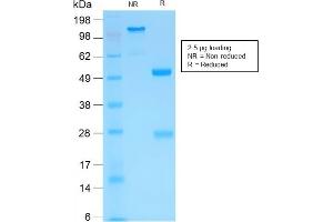 SDS-PAGE Analysis of Purified MMP3 Rabbit Recombinant Monoclonal Antibody (MMP3/1994R). (Rekombinanter MMP3 Antikörper  (AA 317-327))