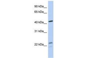 Image no. 1 for anti-Branched Chain Keto Acid Dehydrogenase E1, alpha Polypeptide (BCKDHA) (AA 71-120) antibody (ABIN6743978) (BCKDHA Antikörper  (AA 71-120))
